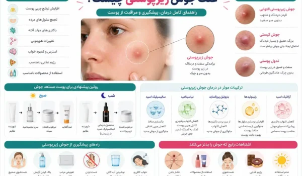 اینفوگرافیک علت جوش زیرپوستی، علائم، روش‌های درمان و راهکارهای پیشگیری از آکنه زیرپوستی