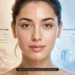 علت خشکی پوست صورت و بهترین روش درمان خشکی و کدر شدن پوست